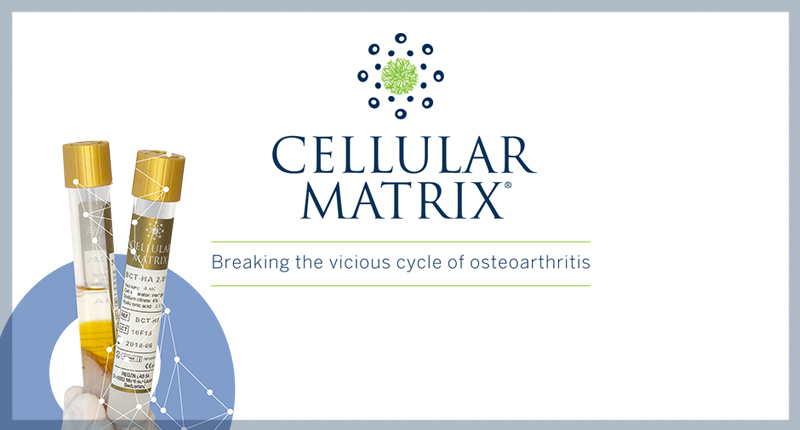 CentroFisioterapicoAurelio_news_cellular-matrix-1.jpg