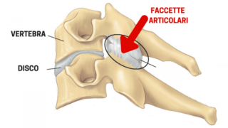 Faccette articolari - Centro Fisioterapico Aurelio